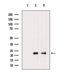 Invitrogen DUSP14 Polyclonal Antibody 100 &mu;L; Unconjugated:Antibodies,