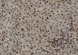 Invitrogen ZIC Pan Polyclonal Antibody 100 &mu;L; Unconjugated:Antibodies,