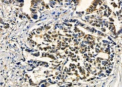 Invitrogen ZNF7 Polyclonal Antibody 100 &mu;L | Buy Online | Invitrogen&trade; | Fisher Scientific