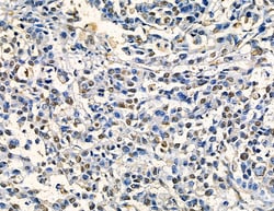 Invitrogen ZNF7 Polyclonal Antibody 100 &mu;L | Buy Online | Invitrogen&trade; | Fisher Scientific