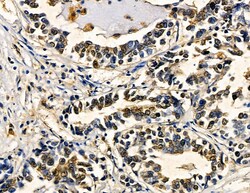 Invitrogen ZNF7 Polyclonal Antibody 100 &mu;L | Buy Online | Invitrogen&trade; | Fisher Scientific