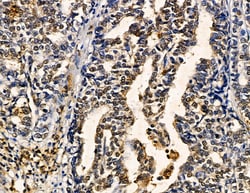 Invitrogen ZNF7 Polyclonal Antibody 100 &mu;L | Buy Online | Invitrogen&trade; | Fisher Scientific