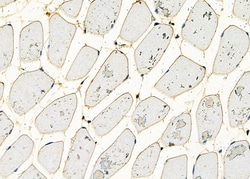 Invitrogen ZNF7 Polyclonal Antibody 100 &mu;L | Buy Online | Invitrogen&trade; | Fisher Scientific