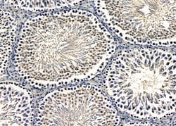 Invitrogen ZNF7 Polyclonal Antibody 100 &mu;L | Buy Online | Invitrogen&trade; | Fisher Scientific