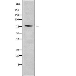 Invitrogen ZNF7 Polyclonal Antibody 100 &mu;L | Buy Online | Invitrogen&trade; | Fisher Scientific