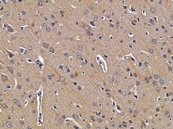 Invitrogen MAPK4 Polyclonal Antibody 100 &mu;L; Unconjugated:Antibodies,