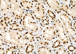 Invitrogen GTF2A2 Polyclonal Antibody 100 &mu;L; Unconjugated:Antibodies,
