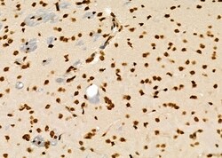 Invitrogen GTF2A2 Polyclonal Antibody 100 &mu;L; Unconjugated:Antibodies,