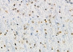 Invitrogen GTF2A2 Polyclonal Antibody 100 &mu;L; Unconjugated:Antibodies,