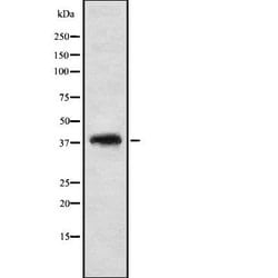 Invitrogen GTF2A2 Polyclonal Antibody 100 &mu;L; Unconjugated:Antibodies,
