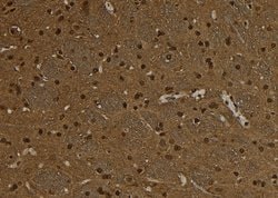 Invitrogen SNRPD3 Polyclonal Antibody 100 &mu;L; Unconjugated:Antibodies,