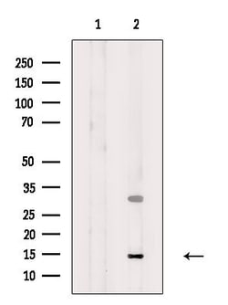 Invitrogen SNRPD3 Polyclonal Antibody 100 &mu;L; Unconjugated:Antibodies,