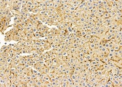Invitrogen MRPS11 Polyclonal Antibody 100 &mu;L; Unconjugated:Antibodies,