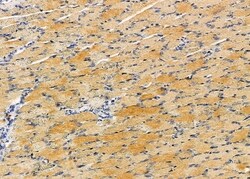 Invitrogen MRPS11 Polyclonal Antibody 100 &mu;L; Unconjugated:Antibodies,