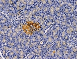 Invitrogen MRPS11 Polyclonal Antibody 100 &mu;L; Unconjugated:Antibodies,