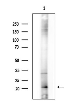 Invitrogen MRPS11 Polyclonal Antibody 100 &mu;L; Unconjugated:Antibodies,