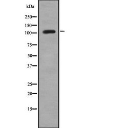 Invitrogen TMPRSS15 Polyclonal Antibody 100 &mu;L | Buy Online | Invitrogen&trade; | Fisher Scientific