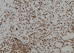 Invitrogen BNC1 Polyclonal Antibody 100 &mu;L; Unconjugated:Antibodies,