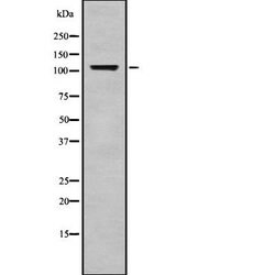 Invitrogen BNC1 Polyclonal Antibody 100 &mu;L; Unconjugated:Antibodies,