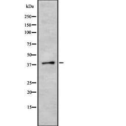 Invitrogen SRSF6 Polyclonal Antibody 100 &mu;L; Unconjugated:Antibodies,