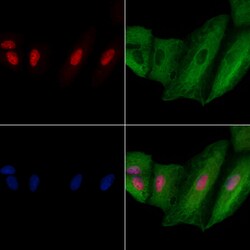 SART3 Polyclonal Antibody:Antibodies, Polyclonal
