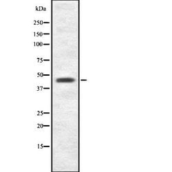 AGK Polyclonal Antibody:Antibodies, Polyclonal