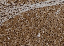 Invitrogen CT47 Polyclonal Antibody 100 &mu;L | Buy Online | Invitrogen&trade; | Fisher Scientific