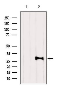 Invitrogen CT47 Polyclonal Antibody 100 &mu;L | Buy Online | Invitrogen&trade; | Fisher Scientific
