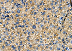 Invitrogen MAP3K15 Polyclonal Antibody 100 &mu;L; Unconjugated:Antibodies,