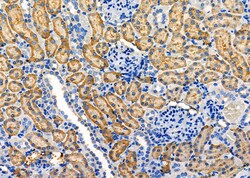 Invitrogen MAP3K15 Polyclonal Antibody 100 &mu;L; Unconjugated:Antibodies,