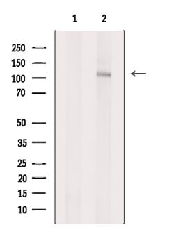 Invitrogen TSHZ1 Polyclonal Antibody 100 &mu;L; Unconjugated:Antibodies,