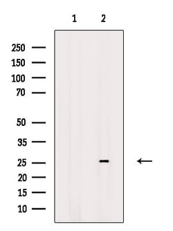 Invitrogen RNF141 Polyclonal Antibody 100 &mu;L; Unconjugated:Antibodies,