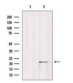 Invitrogen TNFAIP8L1 Polyclonal Antibody 100 &mu;L; Unconjugated:Antibodies,