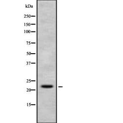 Invitrogen H1FX Polyclonal Antibody 100 &mu;L | Buy Online | Invitrogen&trade; | Fisher Scientific