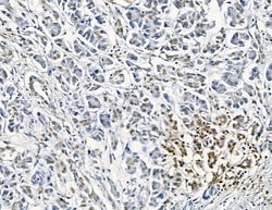 Invitrogen GTF2H4 Polyclonal Antibody 100 &mu;L; Unconjugated:Antibodies,