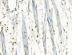 Invitrogen GTF2H4 Polyclonal Antibody 100 &mu;L; Unconjugated:Antibodies,