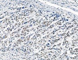 Invitrogen GTF2H4 Polyclonal Antibody 100 &mu;L; Unconjugated:Antibodies,