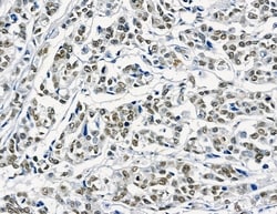 Invitrogen GTF2H4 Polyclonal Antibody 100 &mu;L; Unconjugated:Antibodies,