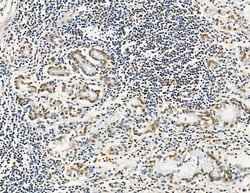 Invitrogen GTF2H4 Polyclonal Antibody 100 &mu;L; Unconjugated:Antibodies,