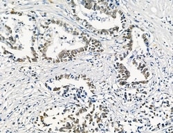 Invitrogen GTF2H4 Polyclonal Antibody 100 &mu;L; Unconjugated:Antibodies,