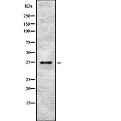 Invitrogen PINX1 Polyclonal Antibody 100 &mu;L; Unconjugated:Antibodies,