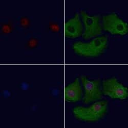 ZNF496 Polyclonal Antibody:Antibodies, Polyclonal