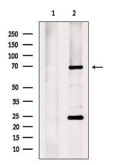 ZNF496 Polyclonal Antibody:Antibodies, Polyclonal