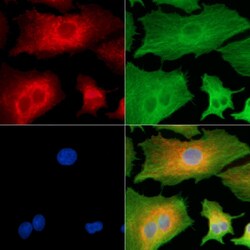 Invitrogen TPD52L3 Polyclonal Antibody 100 &mu;L; Unconjugated:Antibodies,