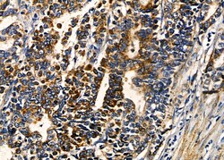 Invitrogen TPD52L3 Polyclonal Antibody 100 &mu;L; Unconjugated:Antibodies,