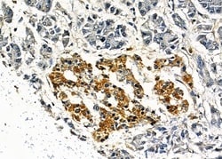 Invitrogen AKAP9 Polyclonal Antibody 100 &mu;L; Unconjugated:Antibodies,