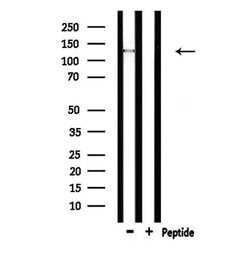 Invitrogen SPZ1 Polyclonal Antibody 100 &mu;L; Unconjugated:Antibodies,