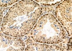 Invitrogen PKD1/2/3/PKC mu Polyclonal Antibody 100 &mu;L; Unconjugated:Antibodies,