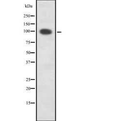 Invitrogen PKD1/2/3/PKC mu Polyclonal Antibody 100 &mu;L; Unconjugated:Antibodies,