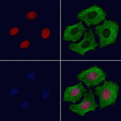 Invitrogen CBX8 Polyclonal Antibody 100 &mu;L; Unconjugated:Antibodies,